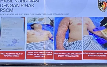 Kasus Penyiraman Air Keras Andrie Yunus: Fakta Baru dan Reaksi Emosi Terdakwa