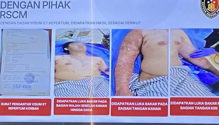 Kasus Penyiraman Air Keras Andrie Yunus: Fakta Baru dan Reaksi Emosi Terdakwa