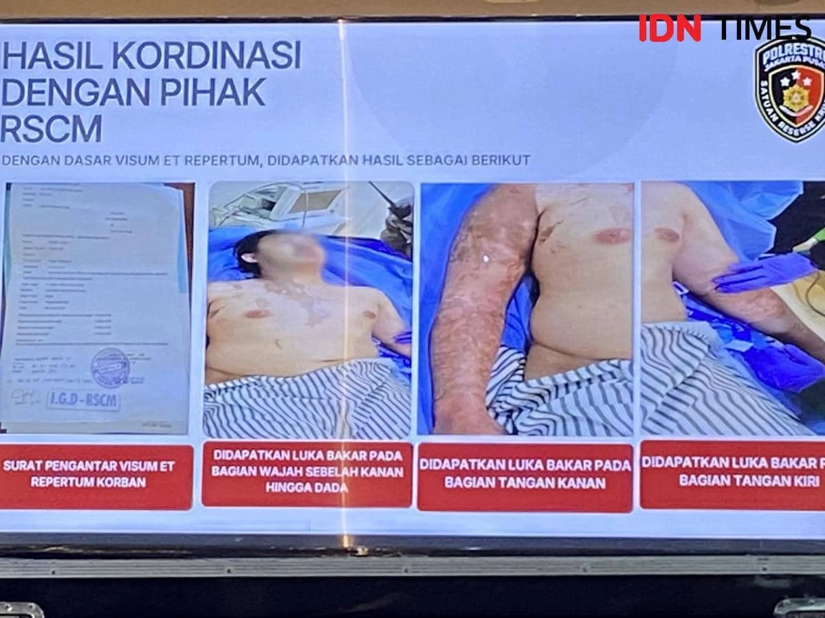 Kasus Penyiraman Air Keras Andrie Yunus: Fakta Baru dan Reaksi Emosi Terdakwa