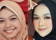 Wajah Ria Ricis yang Bikin Penasaran: Operasi Hidung Ratusan Juta dan Dampaknya pada Kepercayaan Diri