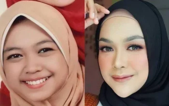 Wajah Ria Ricis yang Bikin Penasaran: Operasi Hidung Ratusan Juta dan Dampaknya pada Kepercayaan Diri