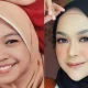 Wajah Ria Ricis yang Bikin Penasaran: Operasi Hidung Ratusan Juta dan Dampaknya pada Kepercayaan Diri