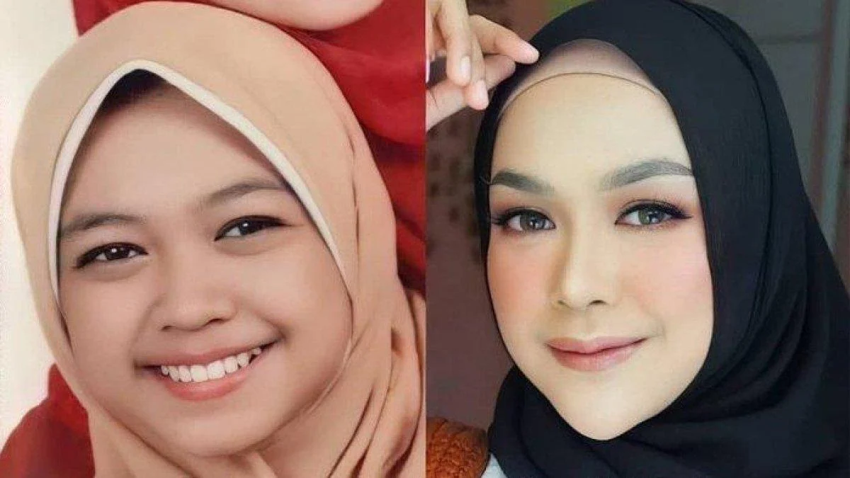 Wajah Ria Ricis yang Bikin Penasaran: Operasi Hidung Ratusan Juta dan Dampaknya pada Kepercayaan Diri