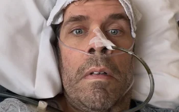 Perez Hilton Dirawat di Rumah Sakit Setelah Livestream Mengkhawatirkan